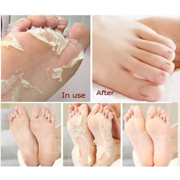 SEXROV American Quality Foot Peel Mask 2 Pack for Cracked Heels,Dead Skin & Call - Picture 5 of 7